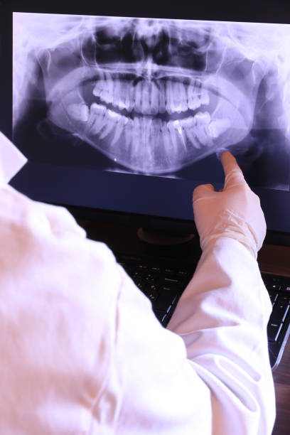 Best Emergency Treatment for Dental Infections or Abscesses in High Bridge, WA