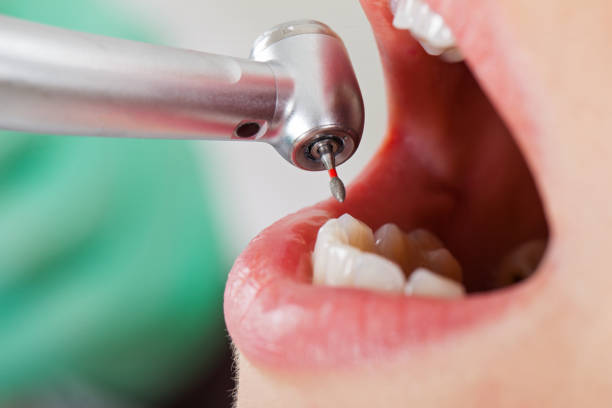 Best Same-Day Emergency Dental Services in High Bridge, WA
